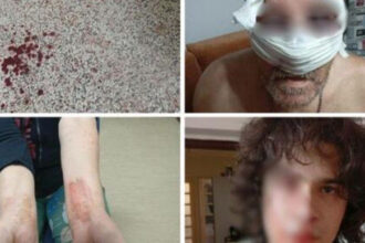 Brutalno pretučena porodica u Tuzli: Jedna osoba uhapšena