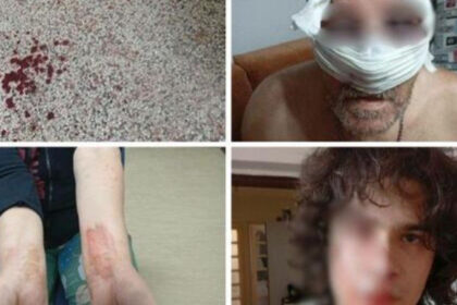 Brutalno pretučena porodica u Tuzli: Jedna osoba uhapšena