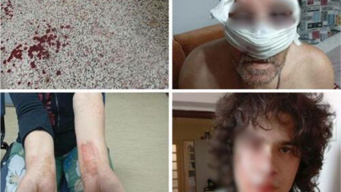 Brutalno pretučena porodica u Tuzli: Jedna osoba uhapšena