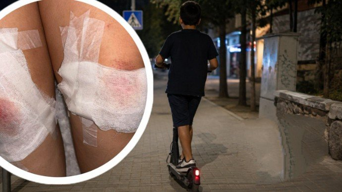 Dijete u Lukavcu udarilo ženu romobilom i pobjeglo