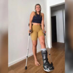 Elvedina Muzaferija slomila nogu na treningu u Švicarskoj: 'Vratit ću se na skije prije nego što mislite'